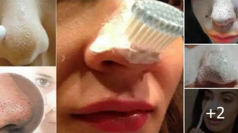 Siyah Nokta Diş Macunu ile Diş Lekelerine Etkili Çözüm ve Ağız Sağlığını Koruma