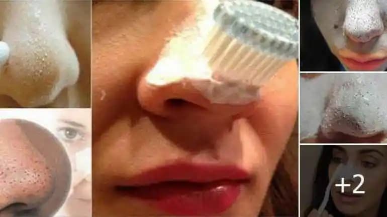 Siyah Nokta Diş Macunu ile Diş Lekelerine Etkili Çözüm ve Ağız Sağlığını Koruma