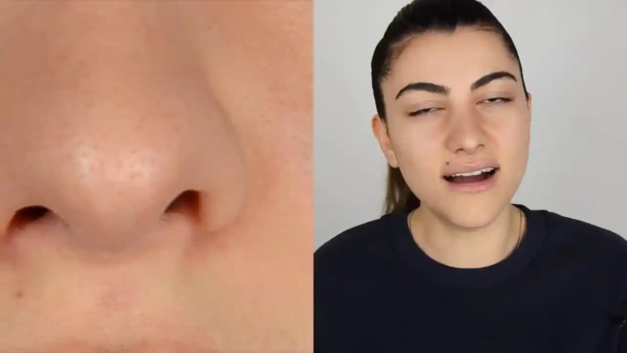 Siyah Noktalarla Mücadele İçin Etkili Yöntemler ve Cilt Bakımı Tavsiyeleri