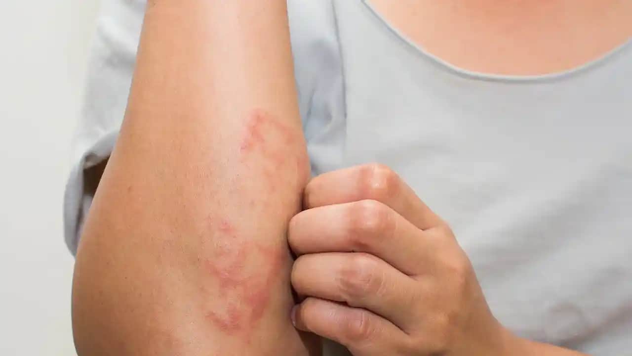 Stres ve Döküntü: Cilt Sağlığını Olumsuz Etkileyen Bağlantılar ve Korunma Yöntemleri