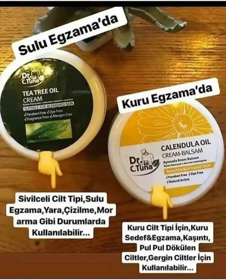 Sulu Egzama İçin En Etkili Kremler ve Doğal Tedavi Yöntemleri
