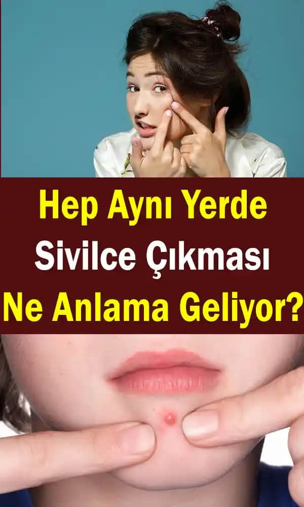 Sürekli Aynı Bölgede Sivilce Çıkmasının Nedenleri ve Etkili Çözüm Yolları