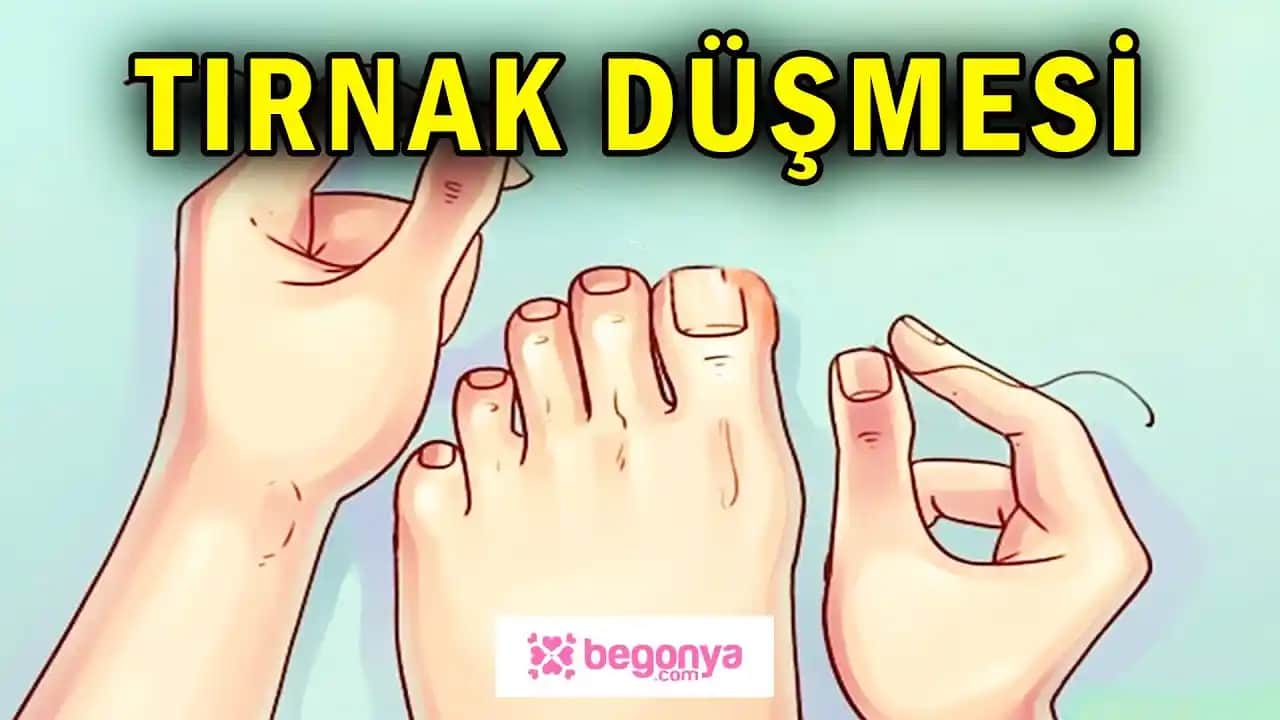 Tırnak Düşmesine Karşı Korunma ve Tedavi Yöntemleri Ayrıntılı Rehber