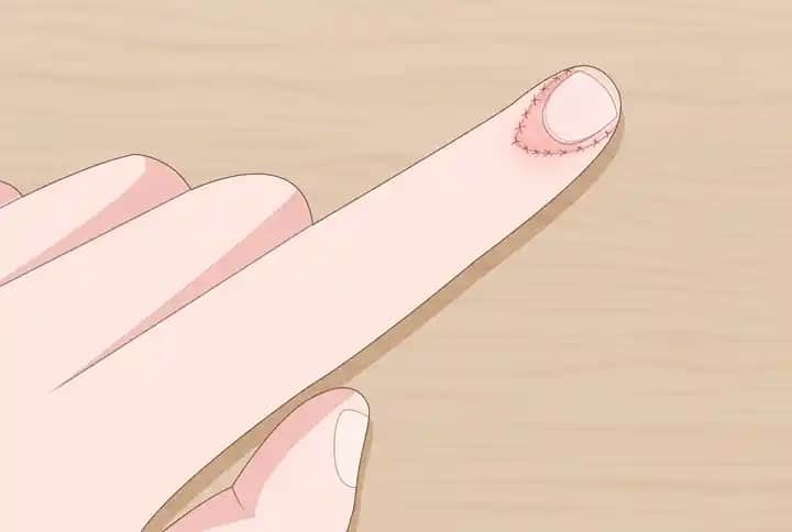 Tırnak Düşmesini Önleyen Doğal Yöntemler ve Bakım İpuçlarıyla Güçlü Tırnaklar