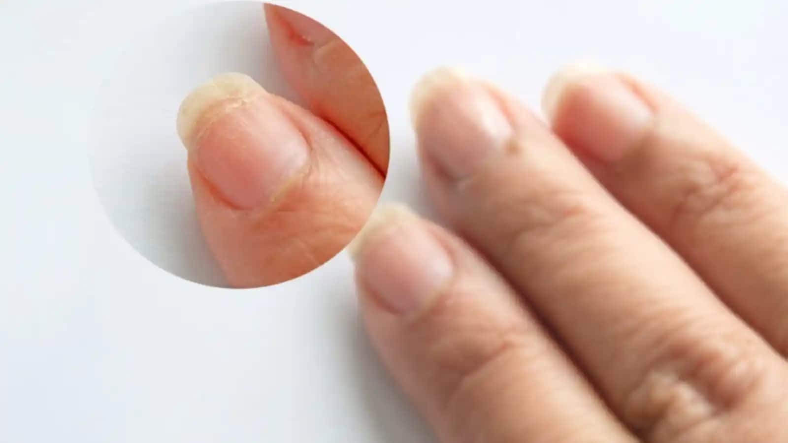 Tırnak Kırılmasını Önleme ve Güçlendirme Yöntemleri Hakkında Detaylı Bilgi