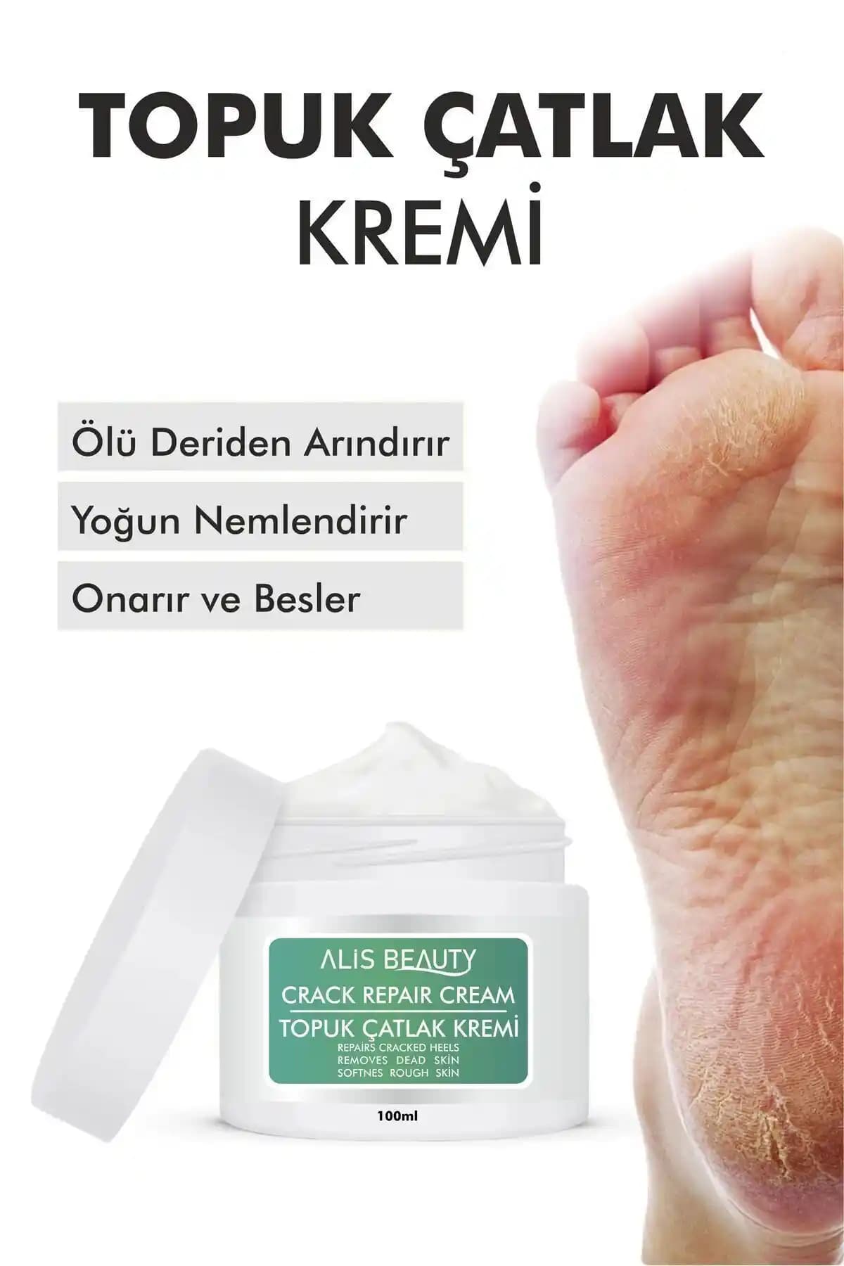 Topuk Çatlağına Karşı En Etkili Kremler ve Bakım Tüyoları