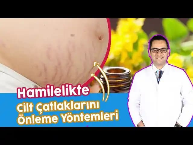 Vücut Çatlaklarına Karşı Doğal ve Kozmetik Yöntemler ile Etkili Çözüm Yolları