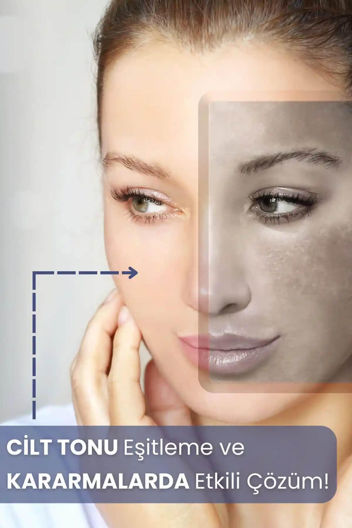 Vücut Lekeleri Nedenleri ve Güncel Tedavi Yöntemleri Hakkında Kapsamlı Bilgi