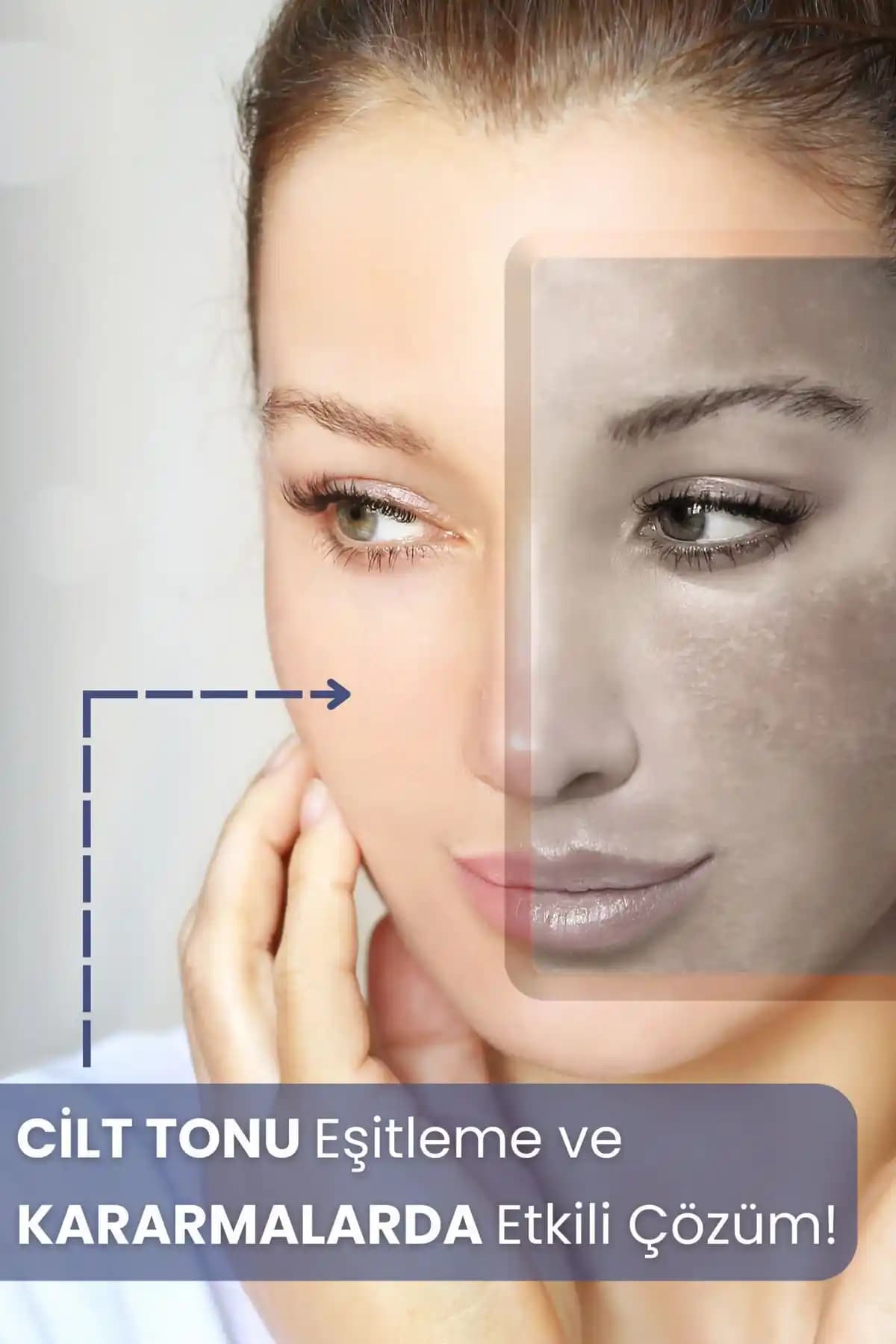 Vücut Lekeleri Nedenleri ve Güncel Tedavi Yöntemleri Hakkında Kapsamlı Bilgi