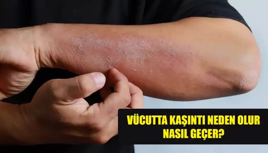 Vücutta Kaşıntı ve Kırmızı Yaralar: Cilt Sağlığını Koruma ve Tedavi Yöntemleri