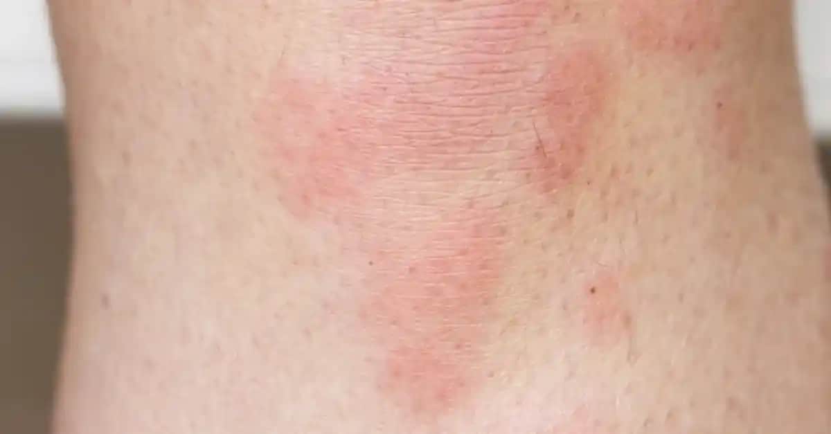 Vücutta Kirlenme Nedenleri ve Etkili Temizlik Yöntemleri Hakkında Kapsamlı Bilgi