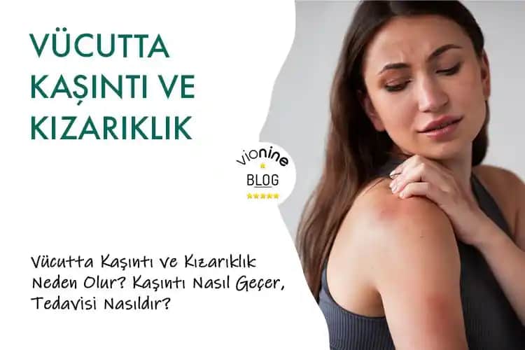 Vücutta Nokta Nokta Kızarıklık ve Kaşıntı Nedenleri, Belirtileri ve Tedavi Seçenekleri