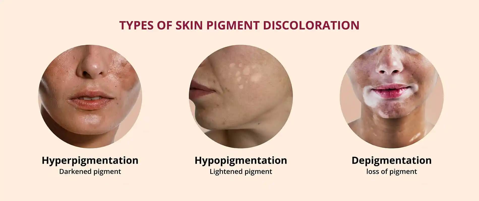 Vücutta Pigment Eksikliği ve Kozmetik Yaklaşımlar: Cilt Tonunu Dengeleyen Etkili Yöntemler