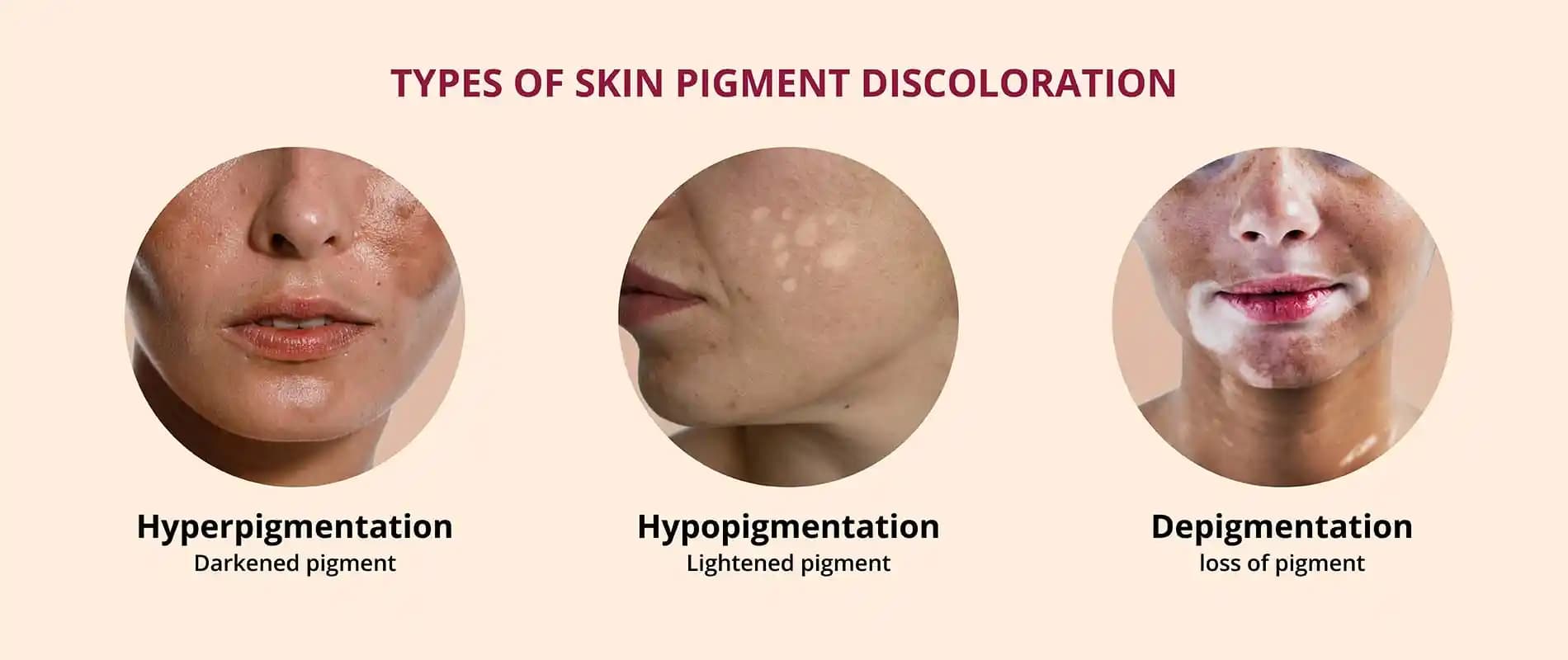 Vücutta Pigment Eksikliği ve Kozmetik Yaklaşımlar: Cilt Tonunu Dengeleyen Etkili Yöntemler