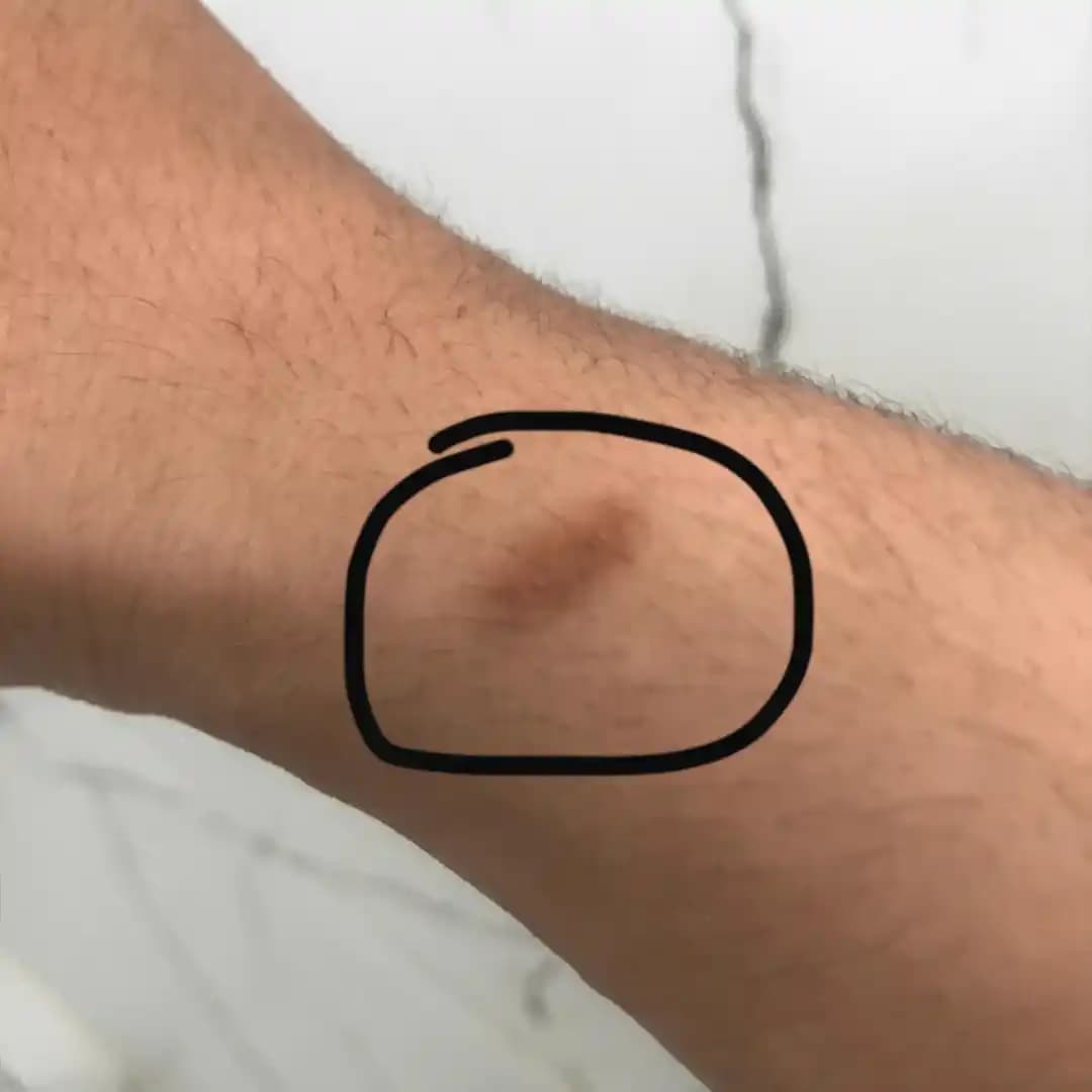 Vücutta Yaraların Nedenleri ve Kozmetik Bakım Yöntemleri Hakkında Kapsamlı Bilgi