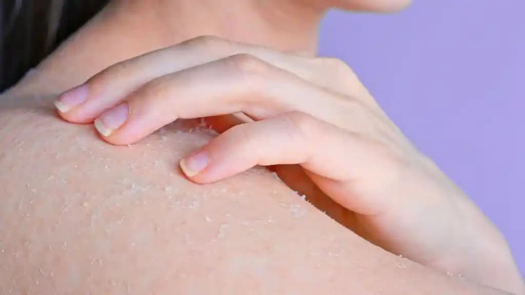 Vücuttaki Ölü Deriyi Temizlemenin En Etkili Yöntemleri ve Cilt Sağlığı İpuçları