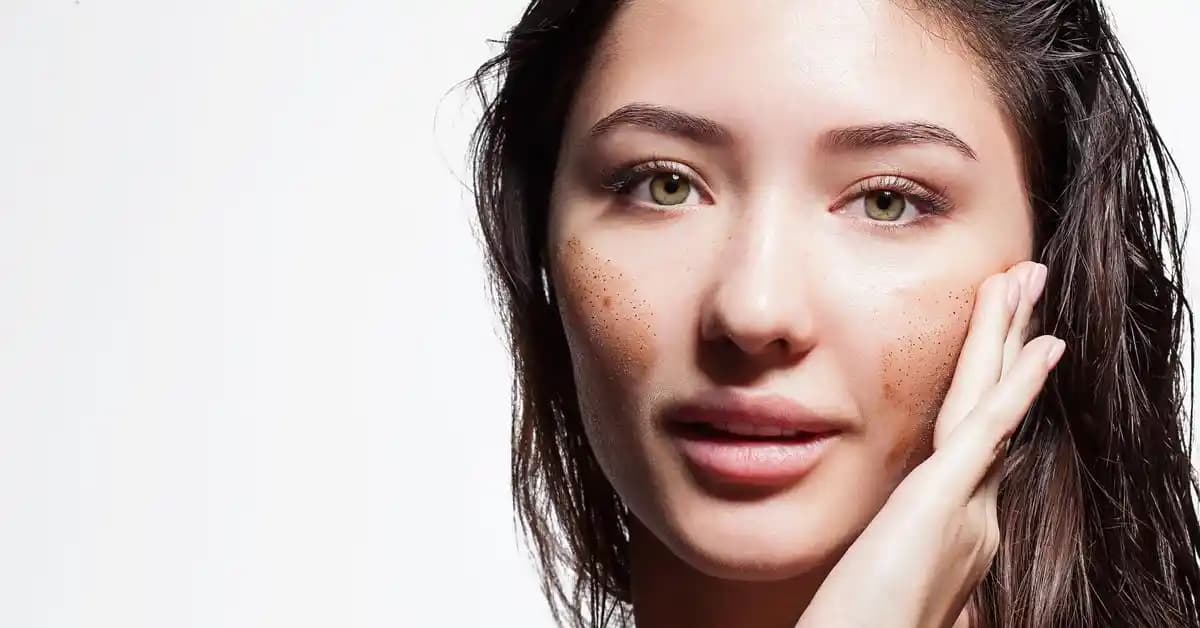 Yağlı Ciltler İçin Peeling Rehberi: Parlak ve Sağlıklı Cilt İçin Doğru Adımlar