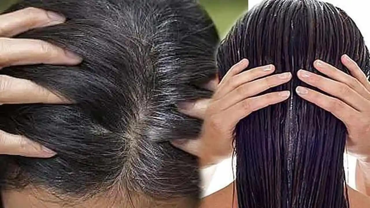 Yağlı Kepek Nasıl Geçer: Etkili ve Doğal Yöntemlerle Saç Derisi Sağlığı