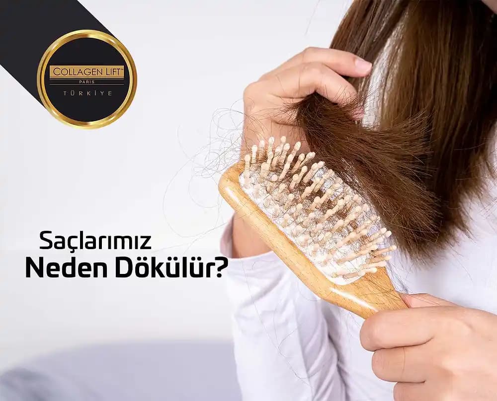 Yağlı Saç Dökülmesi Nedenleri ve Saç Sağlığını Koruma Yöntemleri
