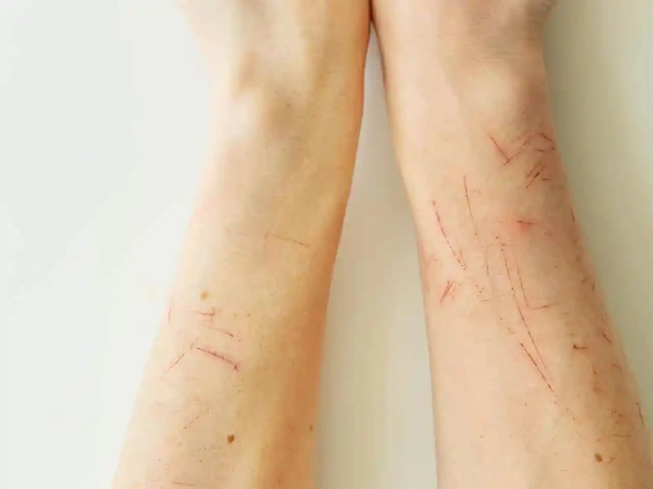 Yara İzlerine İyi Gelen Doğal Yağlar ve Cilt Sağlığını Destekleyen Alternatifler