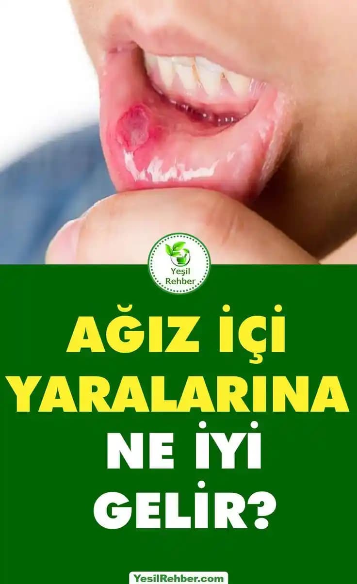 Yara Kızarıklığına Karşı Etkili Doğal ve Kozmetik Çözüm Yöntemleri