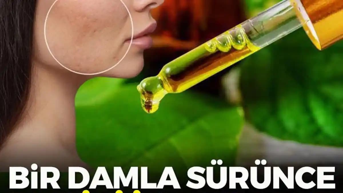 Yara Lekeleri Neden Oluşur ve Güzellik ile Sağlık Açısından Alınabilecek Önlemler