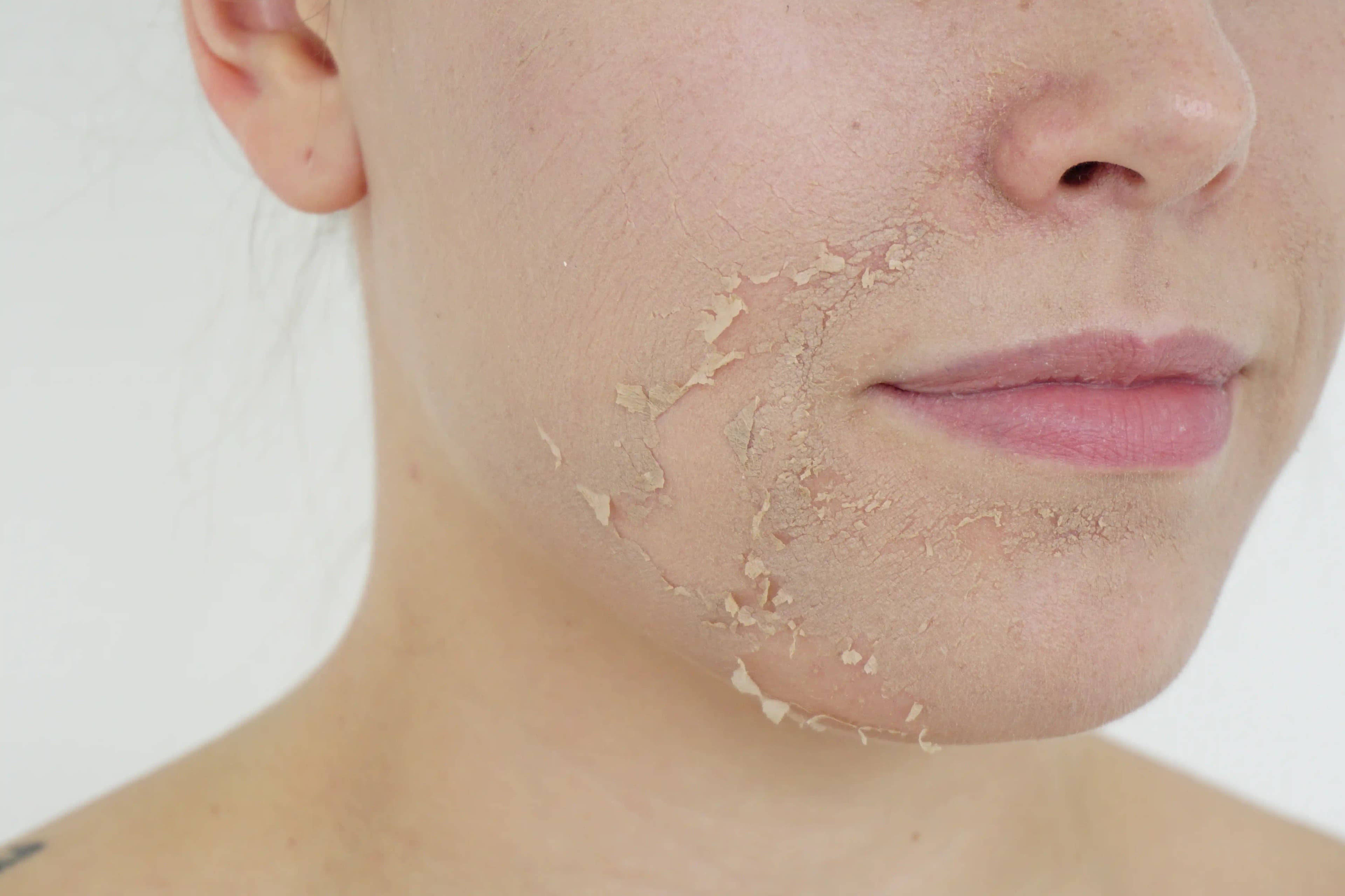 Yeşil Peeling Nedir ve Doğal Güzellik İçin Neden Tercih Edilir