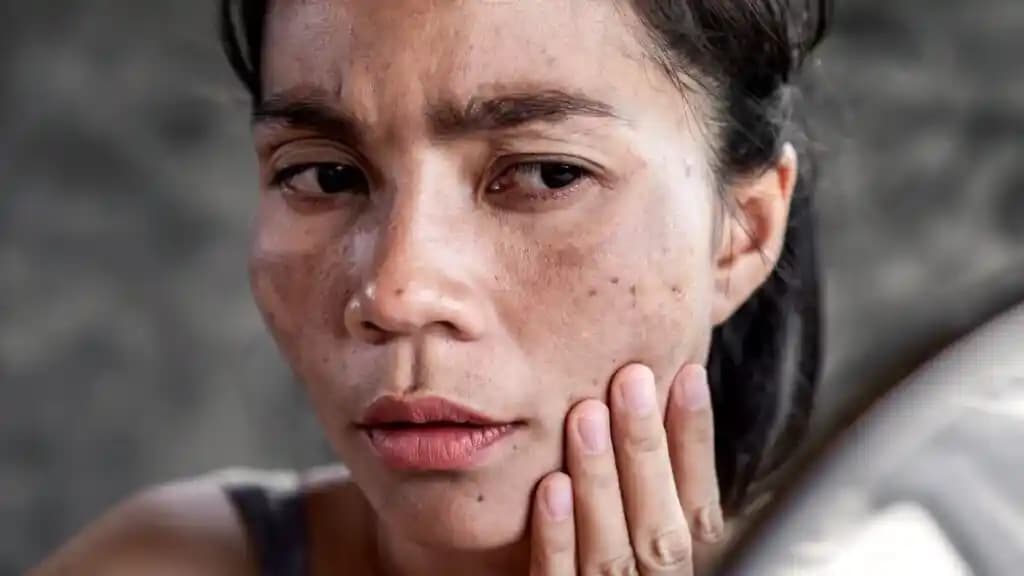 Yüz Kararmasının Nedenleri ve Cilt Sağlığını Koruma Yöntemleri