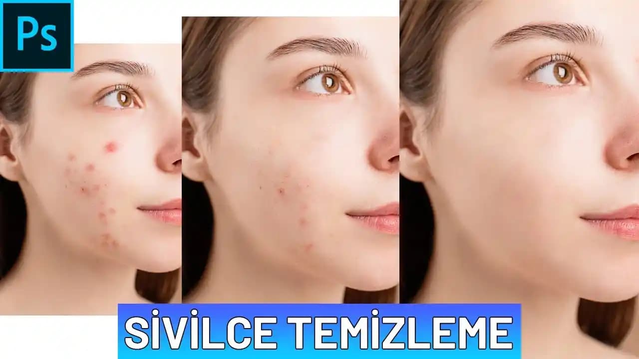 Yüz Pürüzsüzleştirme Yöntemleri ve Cilt Sağlığını Destekleyen En Etkili Teknikler