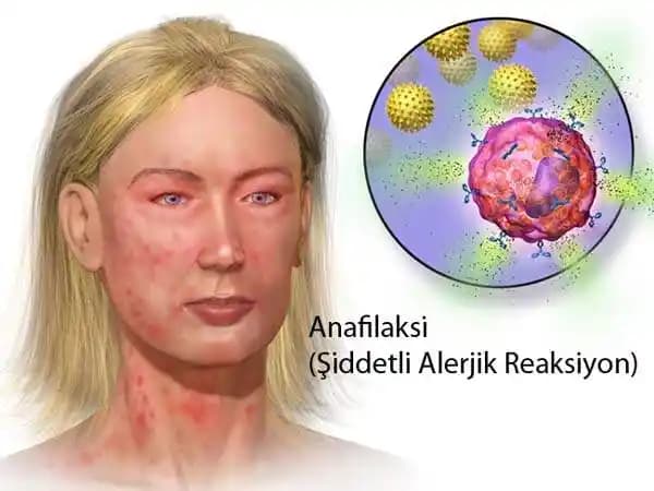 Yüzde Alerjik Reaksiyonlar ve Kozmetik Ürünlerin Rolü Hakkında Kapsamlı Bilgi