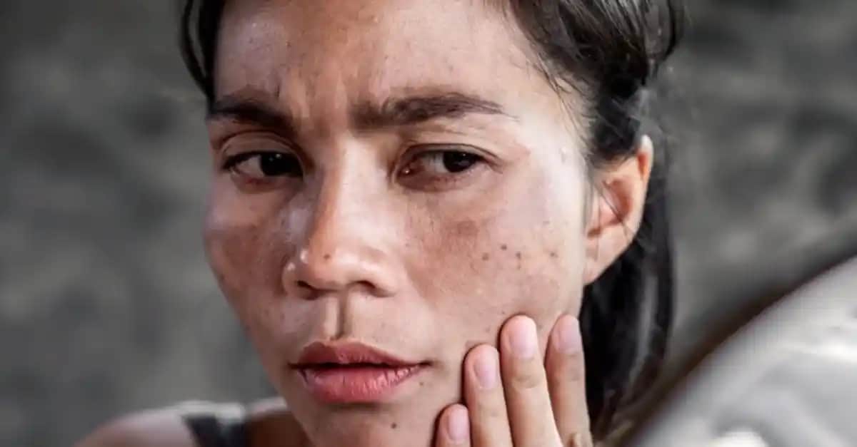 Yüzde Çıkan Lekelerin Nedenleri ve Cilt Sağlığıyla İlişkisi Hakkında Bilgiler