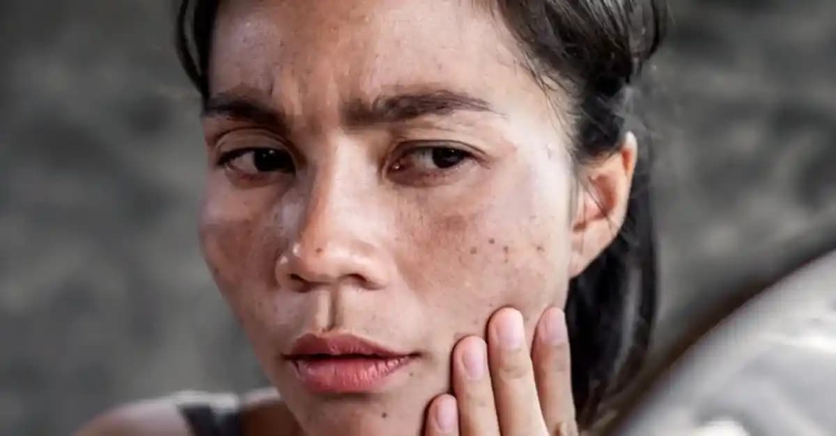 Yüzde Çıkan Lekelerin Nedenleri ve Cilt Sağlığıyla İlişkisi Hakkında Bilgiler