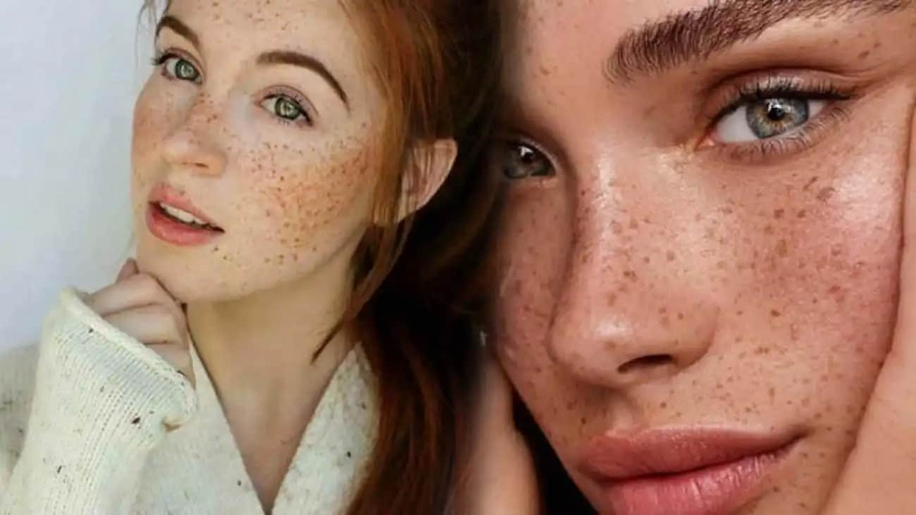 Yüzde Çil Nedenleri ve Güzellik Sırları: Çil Oluşumunu Anlama ve Çözüm Yolları