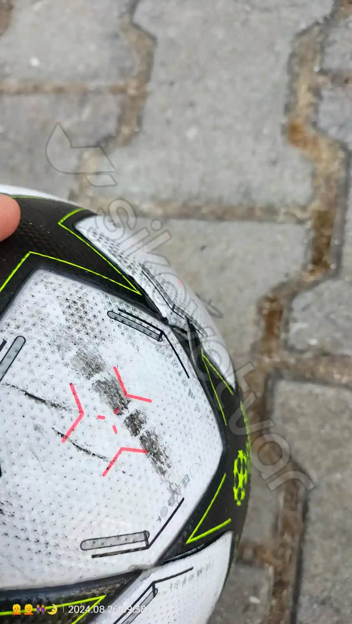 Yüzde Kabuk Atmasının Nedenleri ve Etkili Çözüm Yolları Hakkında Kapsamlı Bilgi