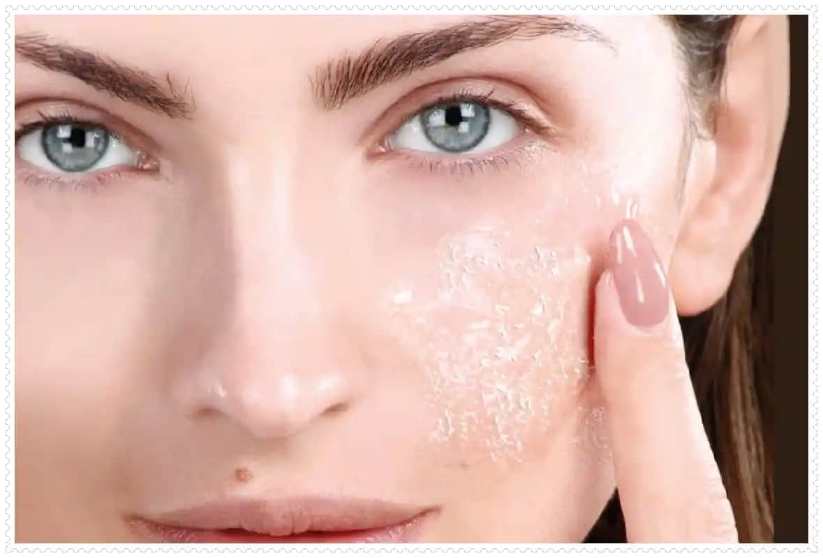 Yüzde Kuru ve Pul Pul Dökülmelerin Nedenleri ve Etkili Çözüm Yolları