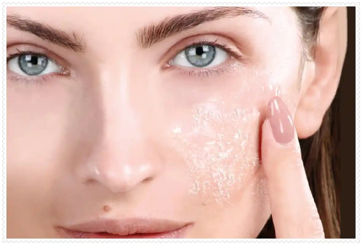 Yüzde Kuru ve Pul Pul Dökülmelerin Nedenleri ve Etkili Çözüm Yolları