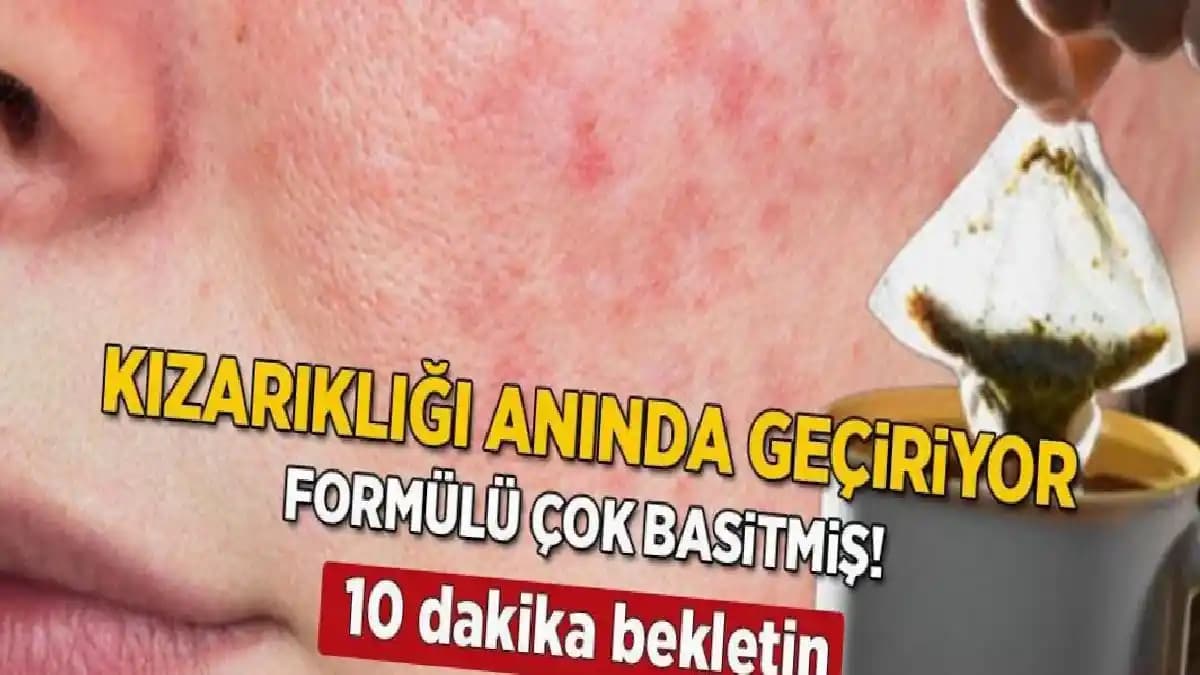 Yüzde Pütürlü Kızarıklıkların Nedenleri ve Etkili Bakım Yöntemleri