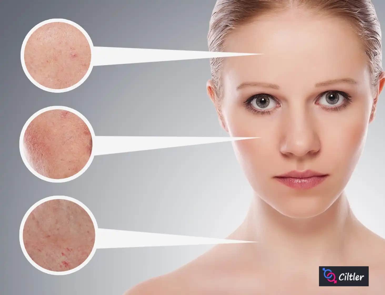 Yüzde Renk Değişikliği ve Güvenli Estetik Yaklaşımlar Hakkında Bilgiler