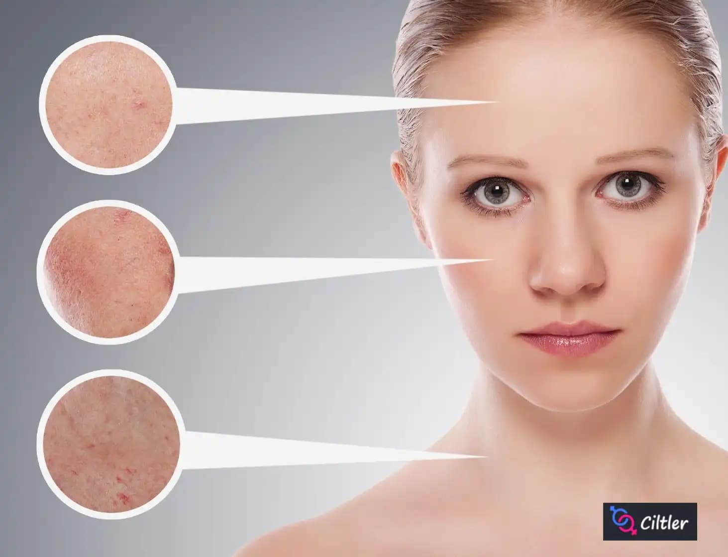 Yüzde Renk Değişikliği ve Güvenli Estetik Yaklaşımlar Hakkında Bilgiler