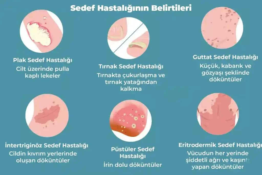 Yüzde Sedef Hastalığı İçin Kozmetik ve Estetik Yaklaşımlar ve Cilt Bakımı Önerileri