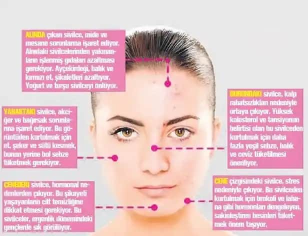 Yüzde Sivilce Nedenleri ve Etkili Çözüm Yöntemleri Hakkında Kapsamlı Bilgi