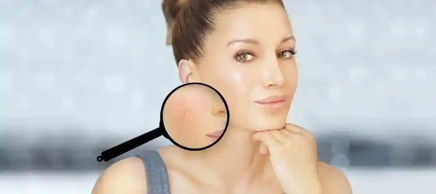 Yüzde Yanma Hissini Hafifletmek ve Cilt Sağlığını Koruma Yöntemleri