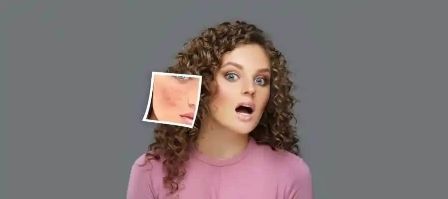 Yüzde Yanma ve Kızarıklık Nedenleri ile Etkili Bakım Yöntemleri