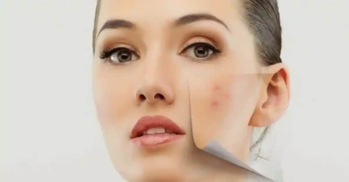 Yüzde Yara Oluşumunun Nedenleri ve Cilt Sağlığını Koruma Yöntemleri