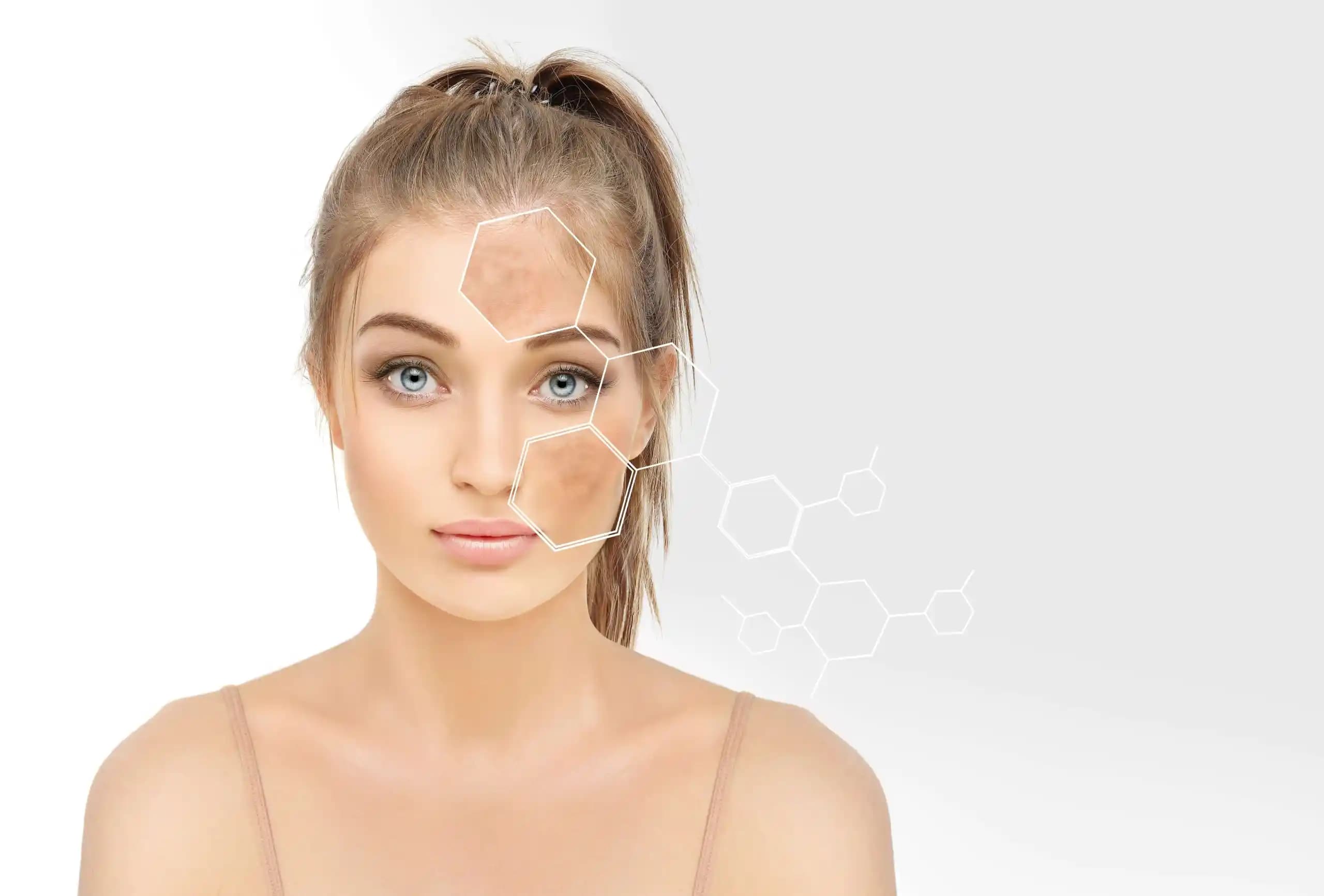 Yüzdeki Çil ve Lekeleri Gidermenin Etkili Yöntemleri ve Doğal Çözümler