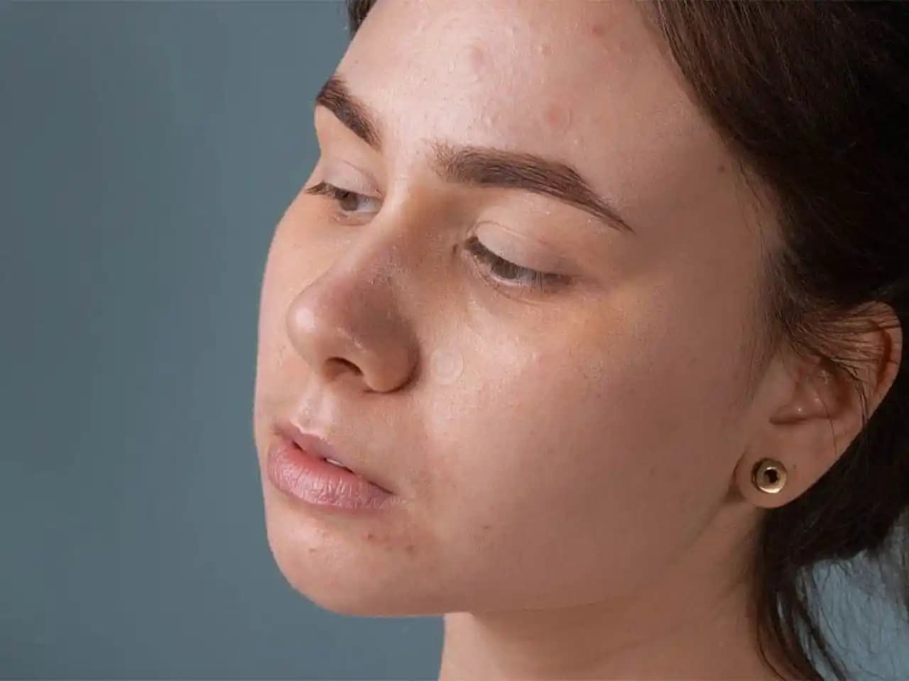 Yüzdeki Kararmalara Karşı Etkili Çözüm Yöntemleri ve Doğal Bakım İpuçları