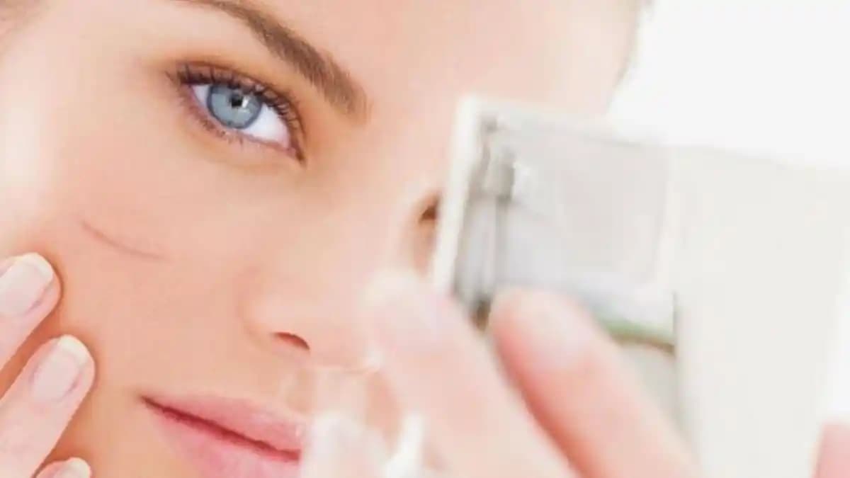 Yüzdeki Kesik İzi Nasıl Geçer: Kozmetik Yöntemler ve Güncel Çözümler