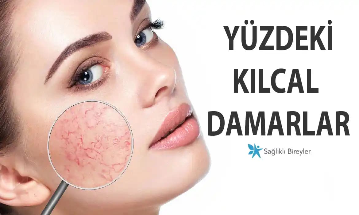 Yüzdeki Kılcal Damar Kızarıklığının Nedenleri ve Günlük Bakım İpuçları