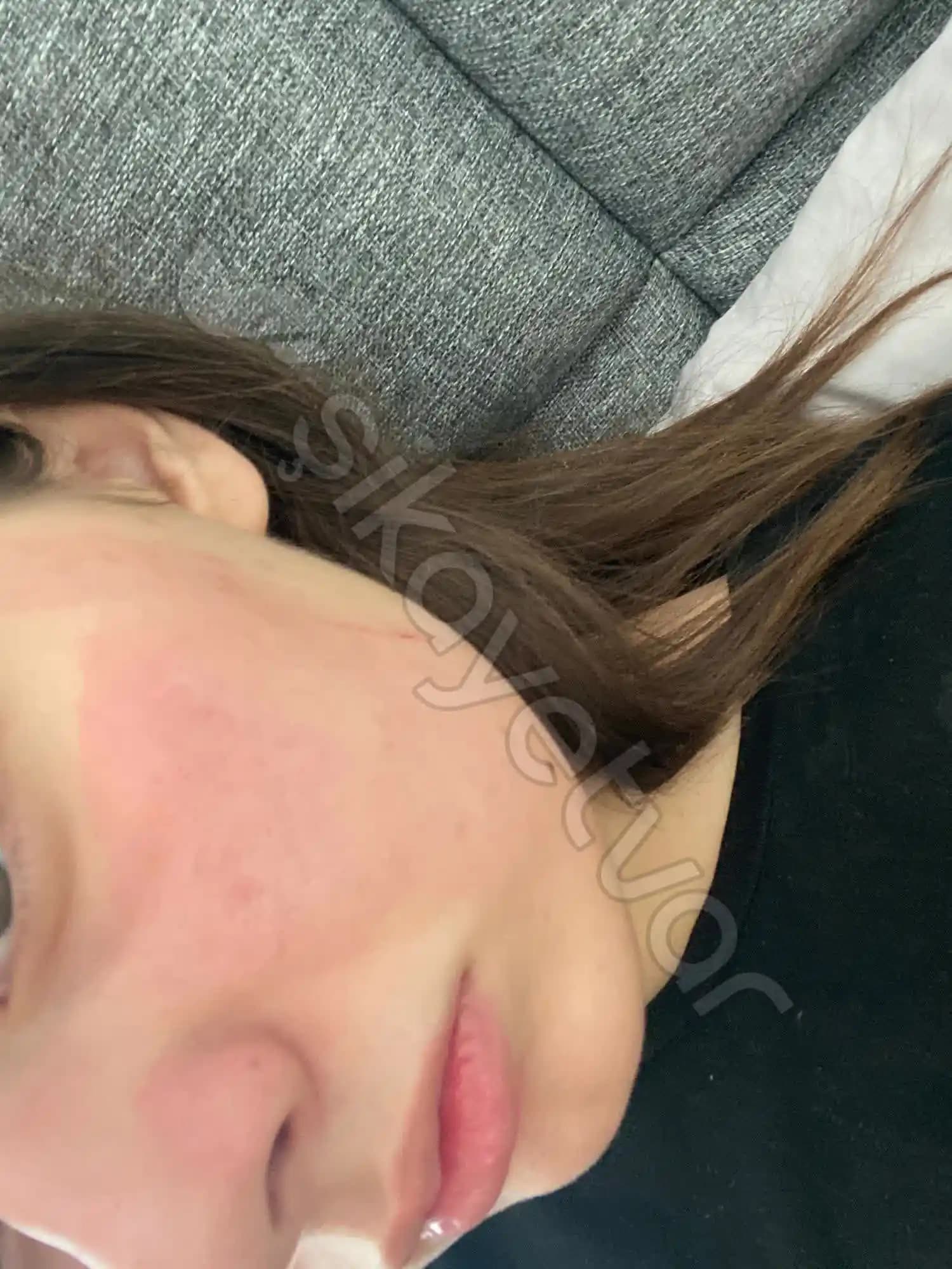 Yüzdeki Kızarıklık Nedenleri ve Etkili Çözüm Yolları Hakkında Detaylı Bilgi