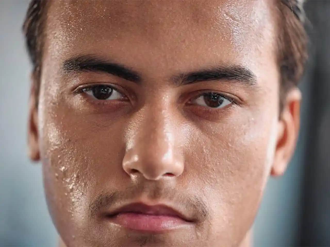 Yüzdeki Lekelerin Nedenleri ve Giderilme Yöntemleri Hakkında Kapsamlı Bilgi